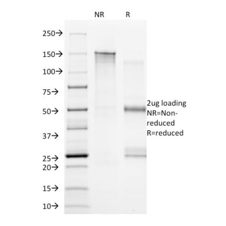 SDS-PAGE - Anti-CD20 Antibody [B9E9] - BSA and Azide free (A253772) - Antibodies.com