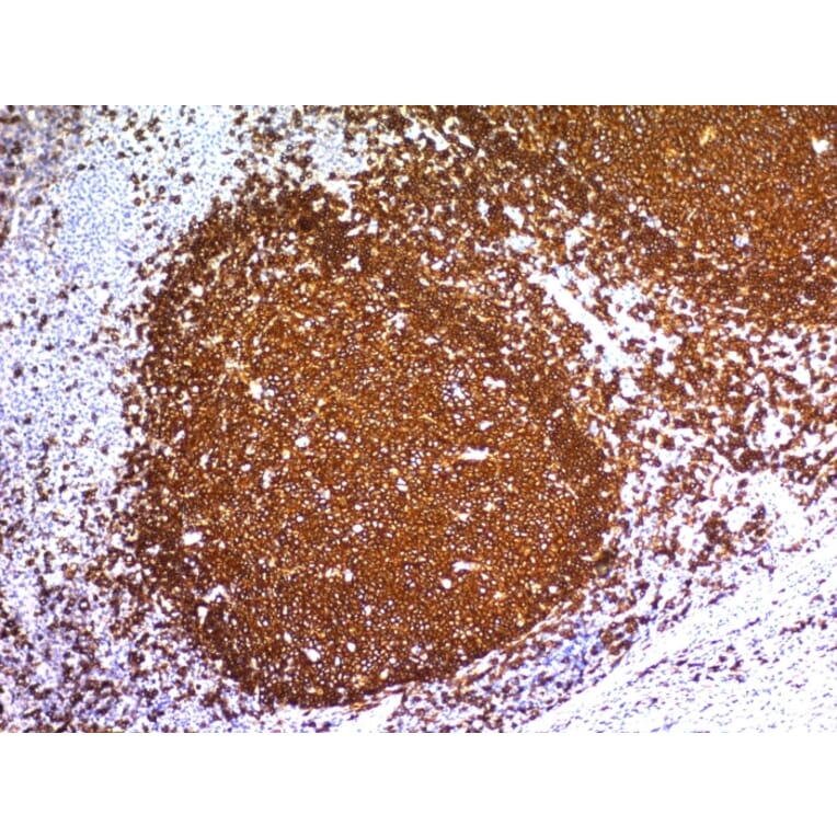 Immunohistochemistry - Anti-CD20 Antibody [L26] - BSA and Azide free (A253774) - Antibodies.com