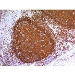 Immunohistochemistry - Anti-CD20 Antibody [L26] - BSA and Azide free (A253774) - Antibodies.com