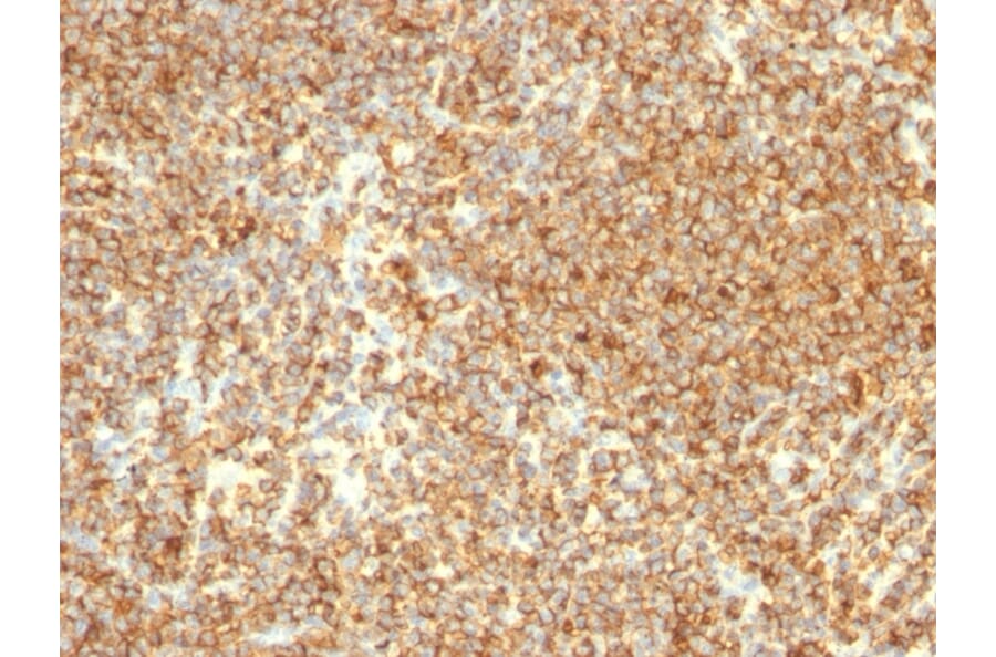 Immunohistochemistry - Anti-CD20 Antibody [L26] - BSA and Azide free (A253774) - Antibodies.com