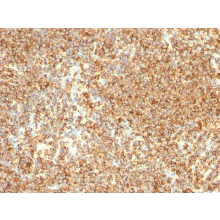 Immunohistochemistry - Anti-CD20 Antibody [L26] - BSA and Azide free (A253774) - Antibodies.com