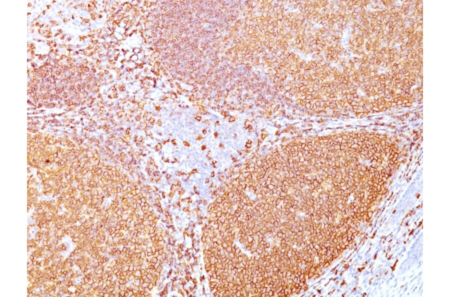 Immunohistochemistry - Anti-CD20 Antibody [IGEL/773] - BSA and Azide free (A253775) - Antibodies.com
