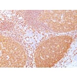 Immunohistochemistry - Anti-CD20 Antibody [IGEL/773] - BSA and Azide free (A253775) - Antibodies.com