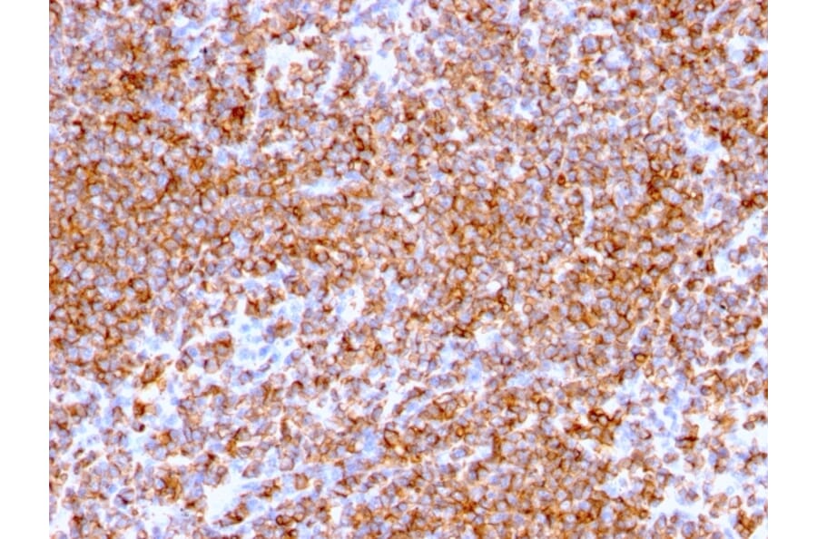 Immunohistochemistry - Anti-CD20 Antibody [IGEL/773] - BSA and Azide free (A253775) - Antibodies.com