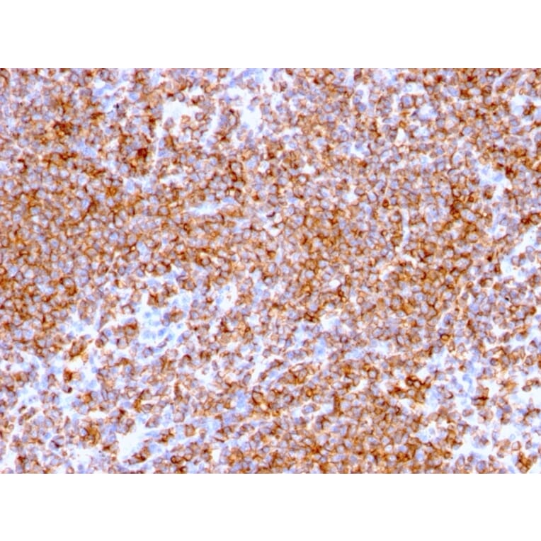 Immunohistochemistry - Anti-CD20 Antibody [IGEL/773] - BSA and Azide free (A253775) - Antibodies.com