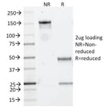 SDS-PAGE - Anti-CD20 Antibody [IGEL/773] - BSA and Azide free (A253775) - Antibodies.com