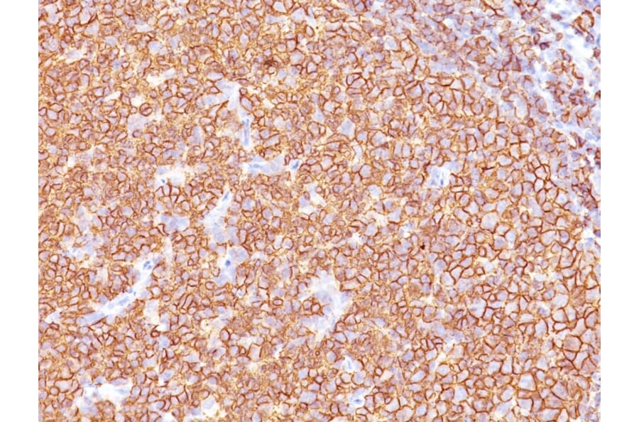 Immunohistochemistry - Anti-CD20 Antibody [SPM618] - BSA and Azide free (A253776) - Antibodies.com