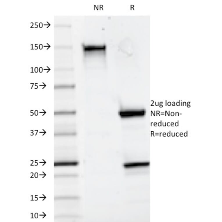 SDS-PAGE - Anti-CD20 Antibody [93-1B3] - BSA and Azide free (A253776) - Antibodies.com
