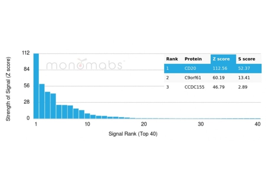 Protein Array - Anti-CD20 Antibody [rIGEL/773] - BSA and Azide free (A253777) - Antibodies.com