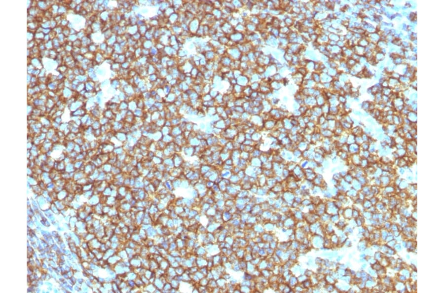 Immunohistochemistry - Anti-CD20 Antibody [rIGEL/773] - BSA and Azide free (A253779) - Antibodies.com