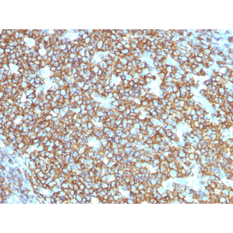 Immunohistochemistry - Anti-CD20 Antibody [rIGEL/773] - BSA and Azide free (A253779) - Antibodies.com