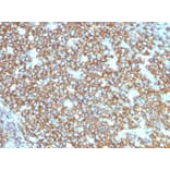 Immunohistochemistry - Anti-CD20 Antibody [rIGEL/773] - BSA and Azide free (A253779) - Antibodies.com