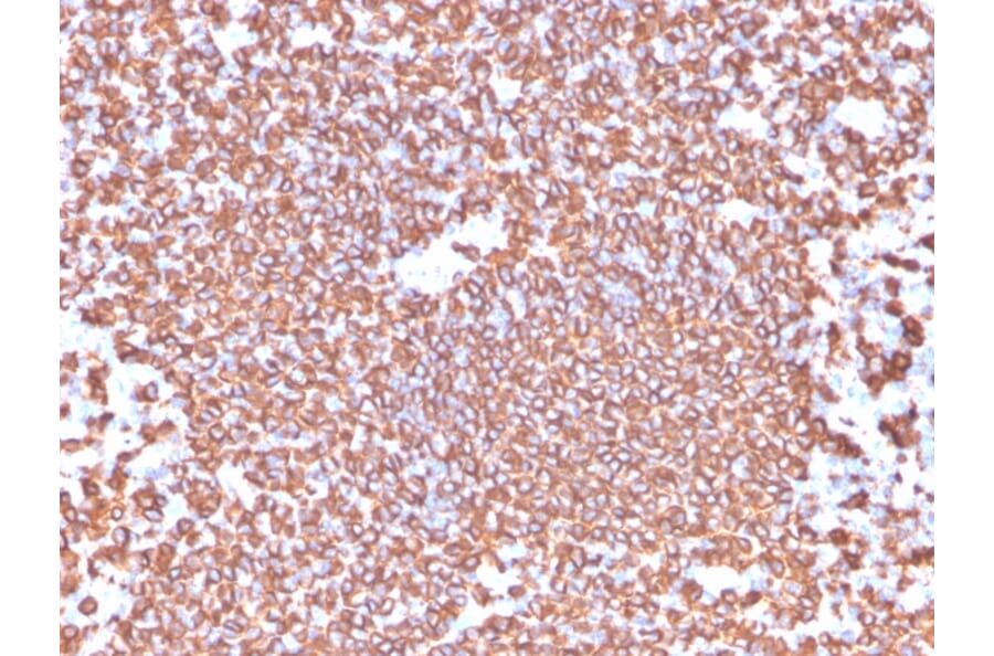 Immunohistochemistry - Anti-CD20 Antibody [IGEL/4524R] - BSA and Azide free (A253780) - Antibodies.com