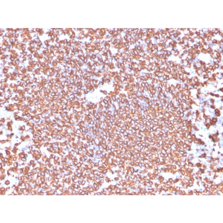 Immunohistochemistry - Anti-CD20 Antibody [IGEL/4524R] - BSA and Azide free (A253780) - Antibodies.com