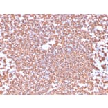 Immunohistochemistry - Anti-CD20 Antibody [IGEL/4524R] - BSA and Azide free (A253780) - Antibodies.com