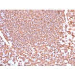 Immunohistochemistry - Anti-CD20 Antibody [IGEL/4524R] - BSA and Azide free (A250600) - Antibodies.com