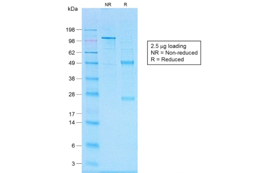 SDS-PAGE - Anti-CD20 Antibody [IGEL/1497R] - BSA and Azide free (A253781) - Antibodies.com