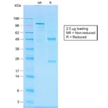 SDS-PAGE - Anti-CD20 Antibody [IGEL/1497R] - BSA and Azide free (A253781) - Antibodies.com