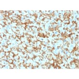 Immunohistochemistry - Anti-CD163 Antibody [M130/1210] - BSA and Azide free (A253783) - Antibodies.com