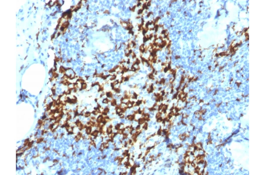 Immunohistochemistry - Anti-CD163 Antibody [M130/2164] - BSA and Azide free (A253786) - Antibodies.com