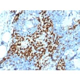 Immunohistochemistry - Anti-CD163 Antibody [M130/2164] - BSA and Azide free (A253786) - Antibodies.com