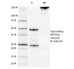 SDS-PAGE - Anti-CD22 Antibody [MYG13] - BSA and Azide free (A253789) - Antibodies.com