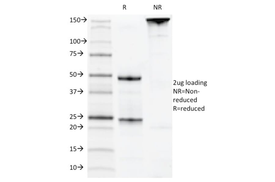 SDS-PAGE - Anti-CD22 Antibody [MYG13] - BSA and Azide free (A253789) - Antibodies.com
