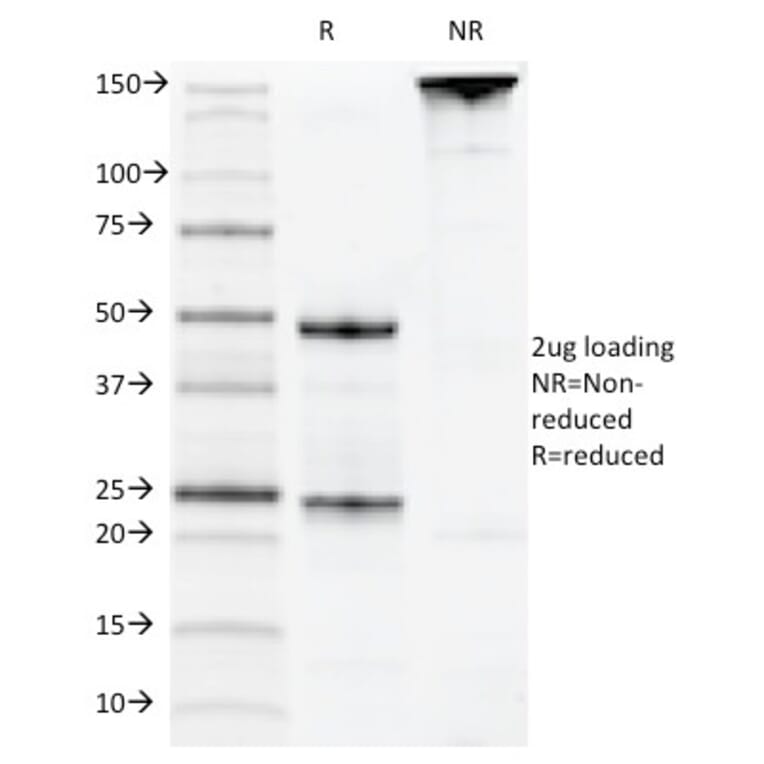SDS-PAGE - Anti-CD22 Antibody [MYG13] - BSA and Azide free (A253789) - Antibodies.com