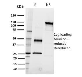 SDS-PAGE - Anti-CD22 Antibody [RFB4] - BSA and Azide free (A253790) - Antibodies.com