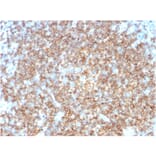 Immunohistochemistry - Anti-CD22 Antibody [BLCAM/1795] - BSA and Azide free (A253791) - Antibodies.com