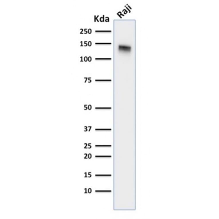Western Blot - Anti-CD22 Antibody [BLCAM/1795] - BSA and Azide free (A253791) - Antibodies.com