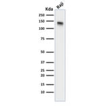 Western Blot - Anti-CD22 Antibody [BLCAM/1795] - BSA and Azide free (A253791) - Antibodies.com