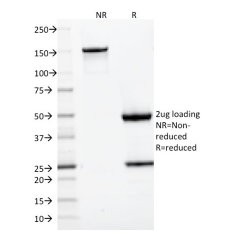 SDS-PAGE - Anti-CD22 Antibody [BLCAM/1795] - BSA and Azide free (A253791) - Antibodies.com
