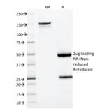 SDS-PAGE - Anti-CD22 Antibody [BLCAM/1795] - BSA and Azide free (A253791) - Antibodies.com