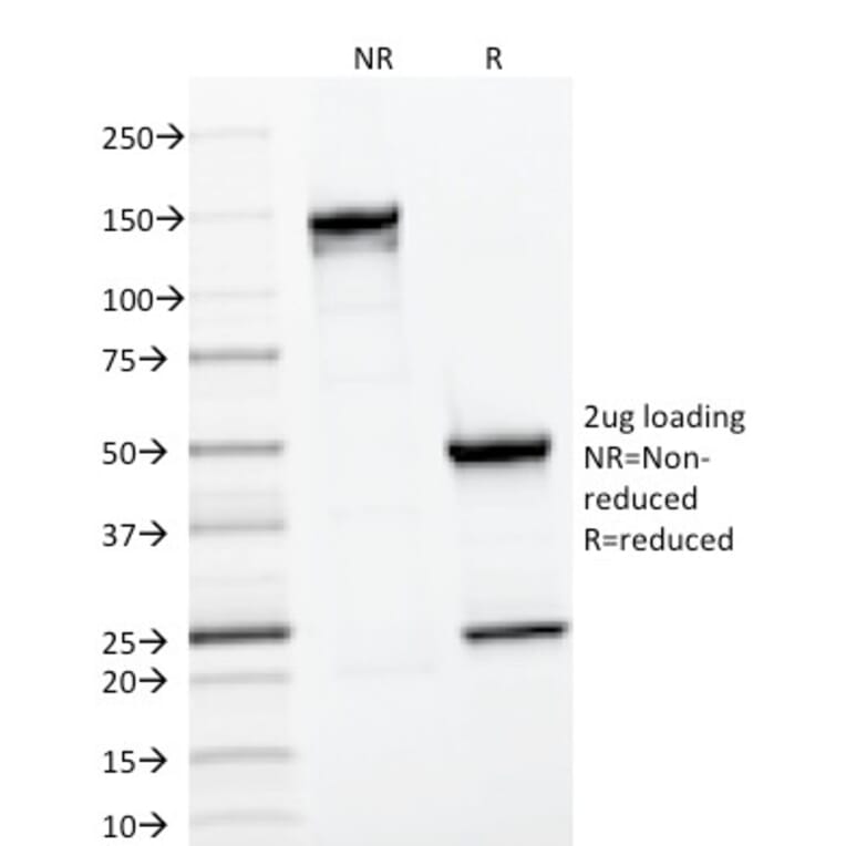 SDS-PAGE - Anti-CD22 Antibody [BLCAM/1796] - BSA and Azide free (A253792) - Antibodies.com