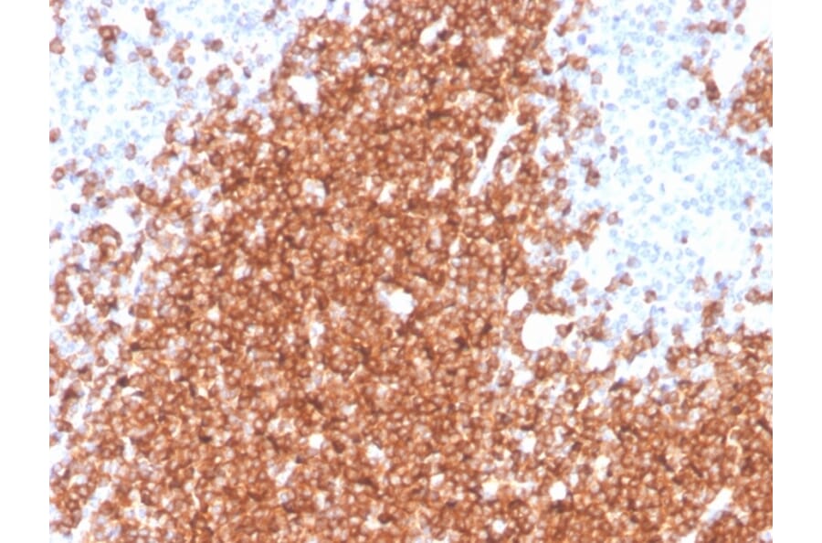 Immunohistochemistry - Anti-CD22 Antibody [rBLCAM/4108] - BSA and Azide free (A253792) - Antibodies.com