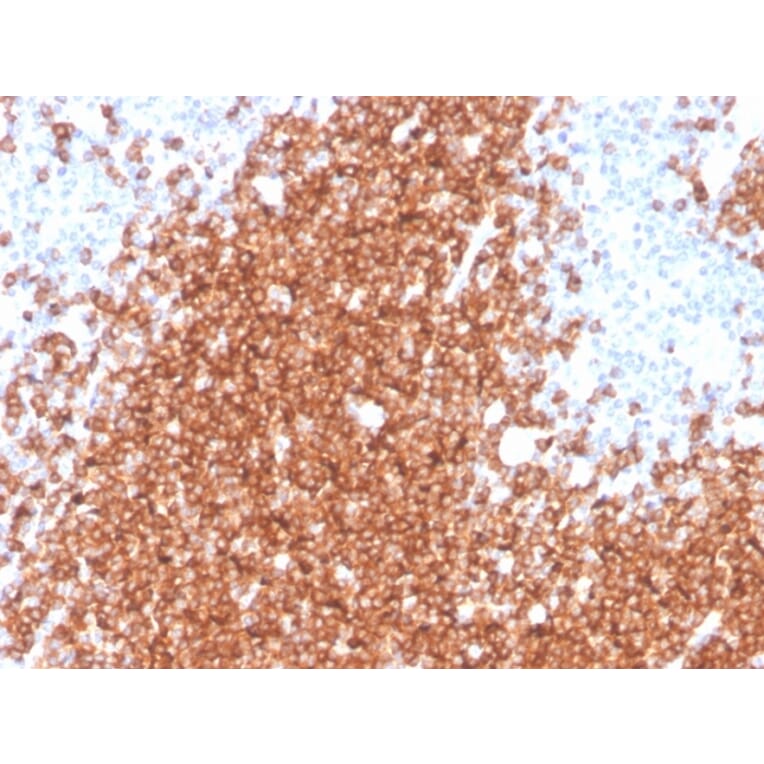 Immunohistochemistry - Anti-CD22 Antibody [rBLCAM/4108] - BSA and Azide free (A253792) - Antibodies.com