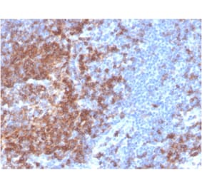 Immunohistochemistry - Anti-CD22 Antibody [BLCAM/2637R] - BSA and Azide free (A253793) - Antibodies.com