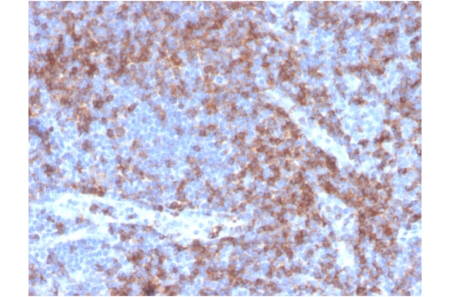 Immunohistochemistry - Anti-CD22 Antibody [BLCAM/2637R] - BSA and Azide free (A253794) - Antibodies.com