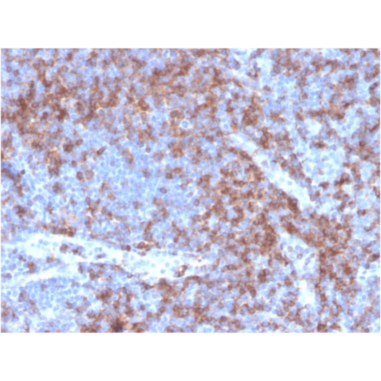 Immunohistochemistry - Anti-CD22 Antibody [BLCAM/2637R] - BSA and Azide free (A253794) - Antibodies.com
