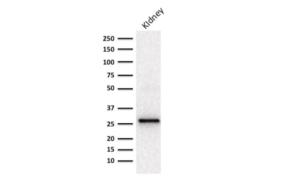Western Blot - Anti-Adiponectin Antibody [ADPN/1370] - BSA and Azide free (A253795) - Antibodies.com