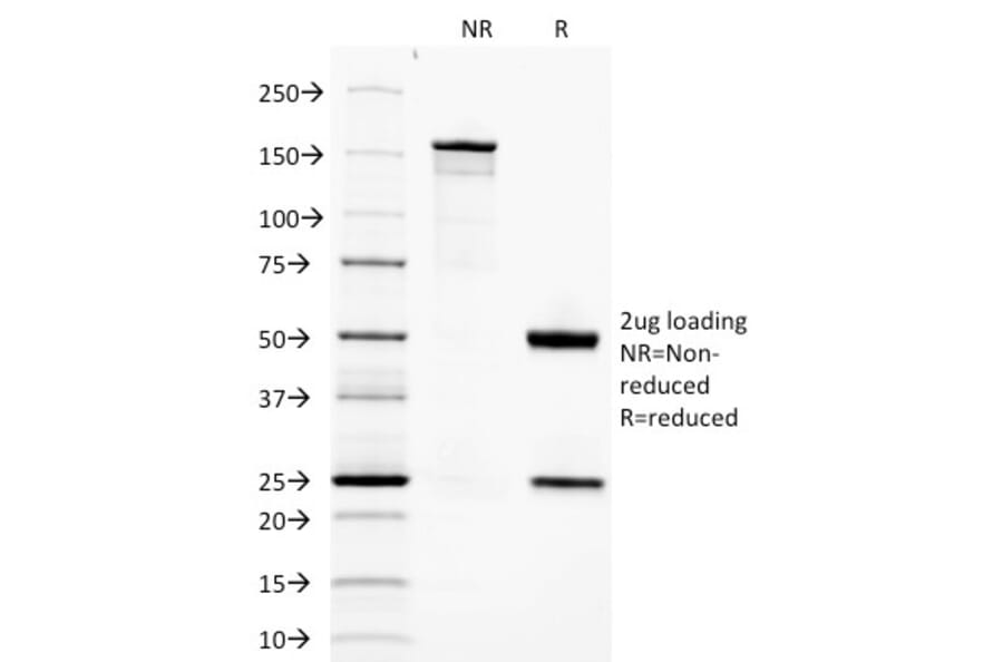 SDS-PAGE - Anti-Adiponectin Antibody [ADPN/1370] - BSA and Azide free (A253795) - Antibodies.com