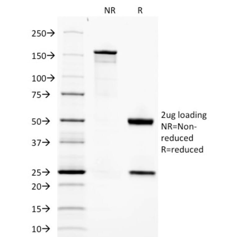 SDS-PAGE - Anti-Adiponectin Antibody [ADPN/1370] - BSA and Azide free (A253795) - Antibodies.com