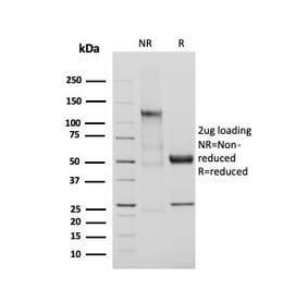 SDS-PAGE - Anti-Adiponectin Antibody [ADPN/4255] - BSA and Azide free (A253795) - Antibodies.com