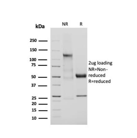 SDS-PAGE - Anti-Adiponectin Antibody [ADPN/4255] - BSA and Azide free (A253795) - Antibodies.com