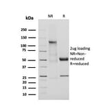 SDS-PAGE - Anti-Adiponectin Antibody [ADPN/4255] - BSA and Azide free (A253795) - Antibodies.com