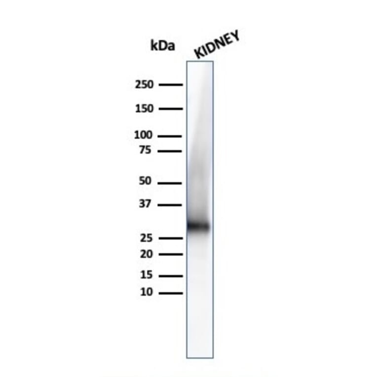 Western Blot - Anti-Adiponectin Antibody [ADPN/4255] - BSA and Azide free (A253796) - Antibodies.com