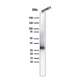 Western Blot - Anti-Adiponectin Antibody [ADPN/4255] - BSA and Azide free (A253796) - Antibodies.com
