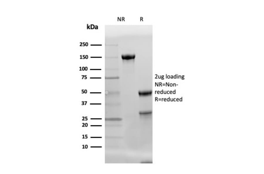SDS-PAGE - Anti-Adiponectin Antibody [ADPN/4256] - BSA and Azide free (A253797) - Antibodies.com