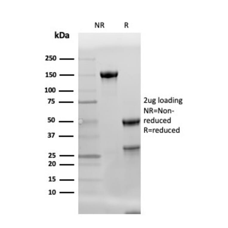 SDS-PAGE - Anti-Adiponectin Antibody [ADPN/4256] - BSA and Azide free (A253797) - Antibodies.com